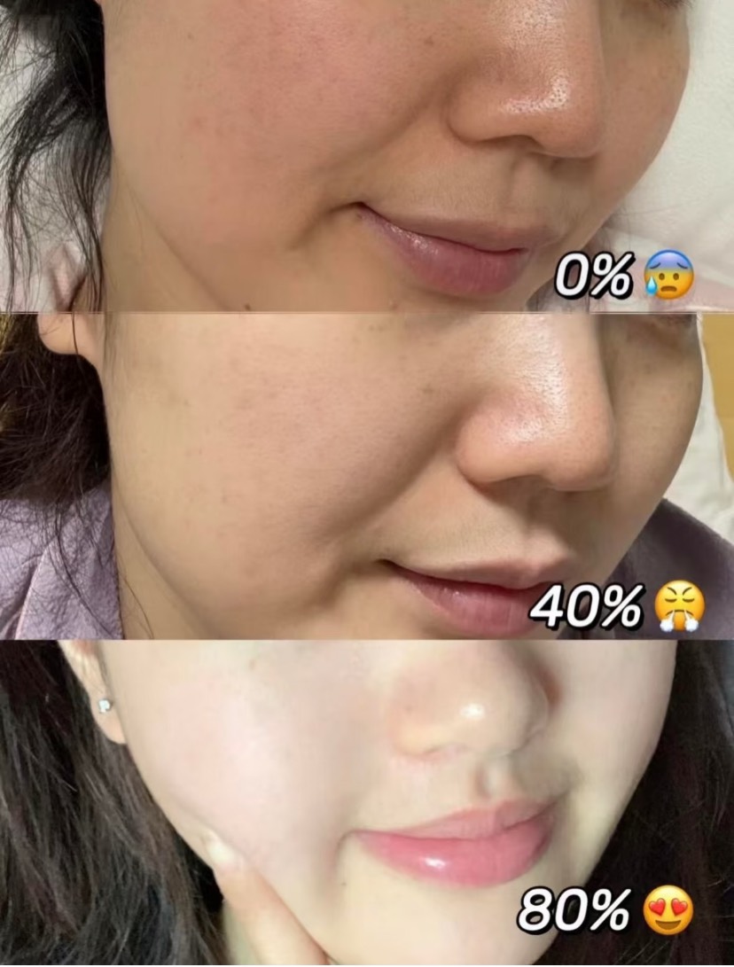 皮膚美白心得
